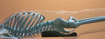 sacro aligner position laying xray