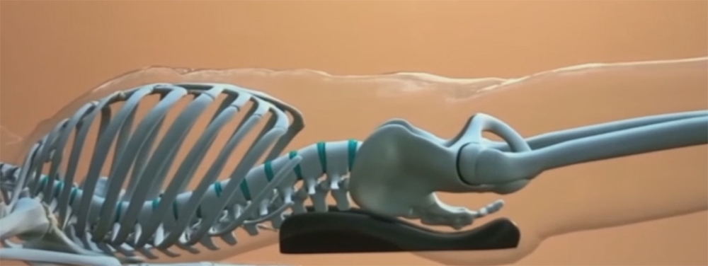 sacro aligner position xray