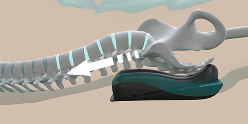 spynamics decompression xray